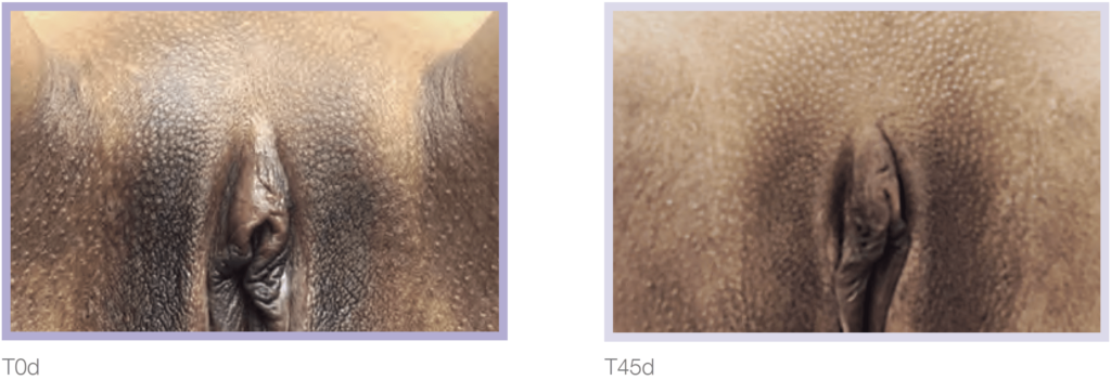 Close-up images comparing two skin textures labeled T0d and T45d, showcasing differences in surface features and appearance.