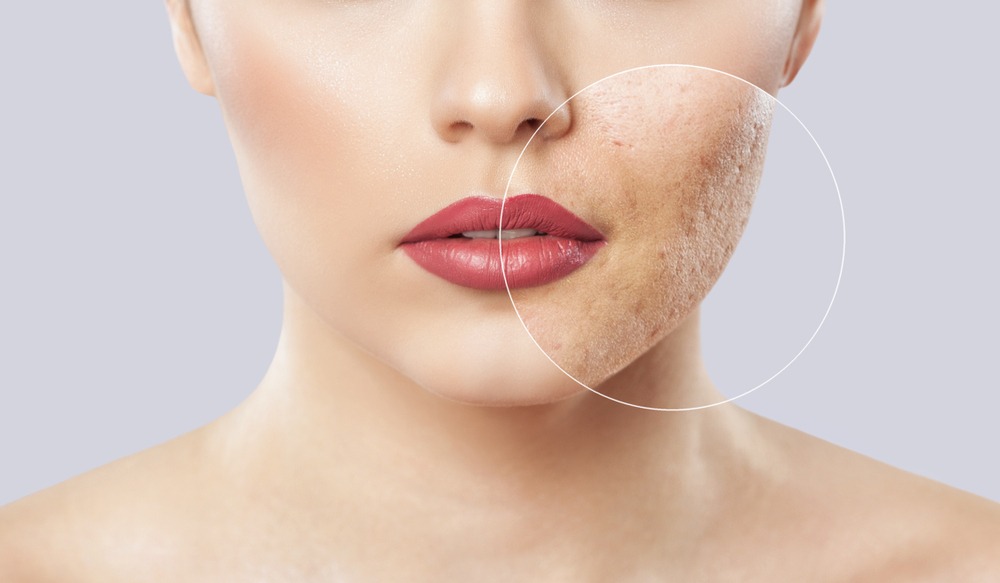 What Can I Do About My Scars?