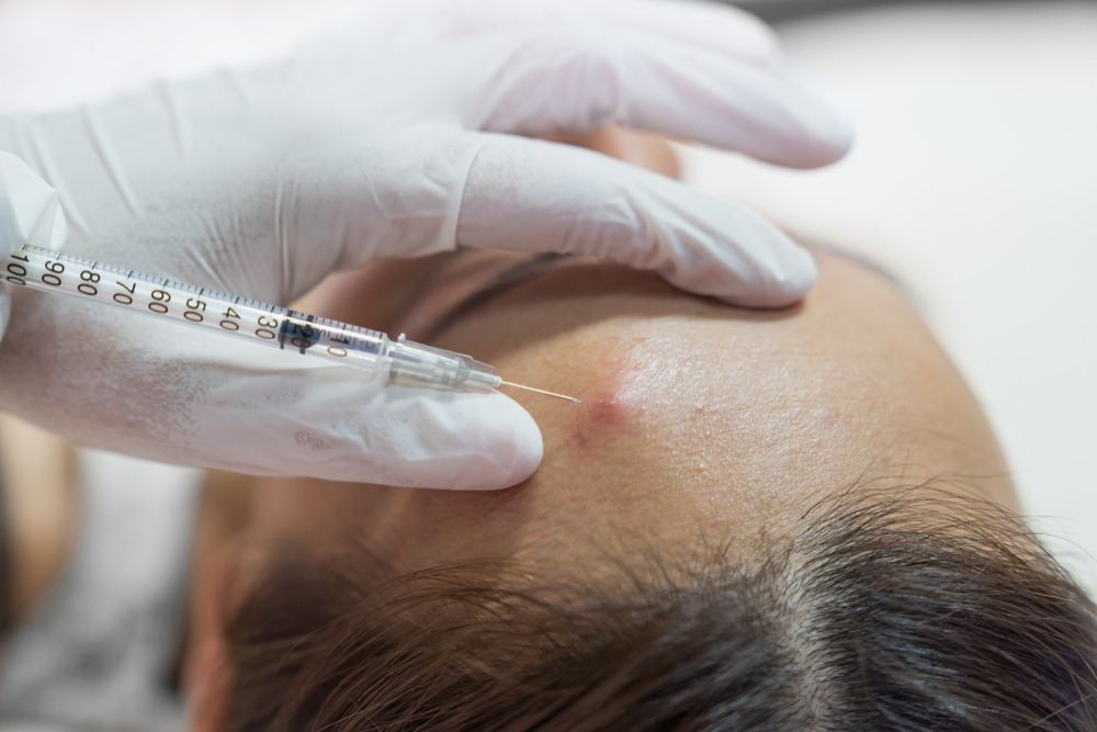 How Do Cortisone Injections Work?
