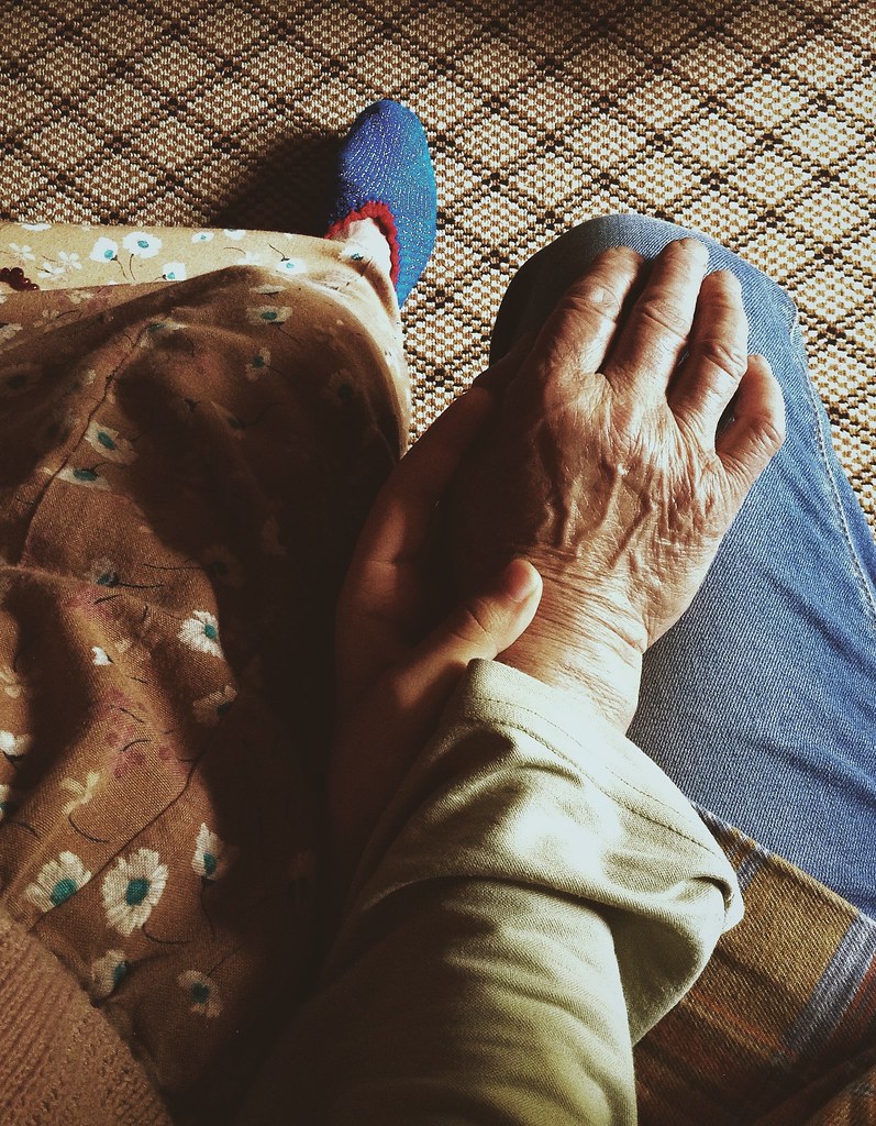 Do Your Hands Look Old? Here’s What To Do